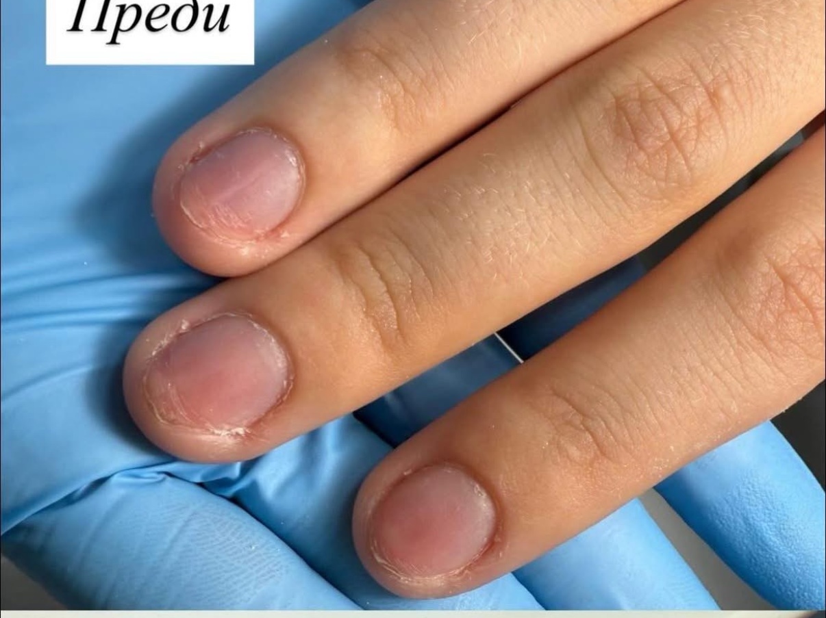 Преди