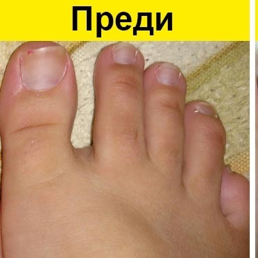 Преди