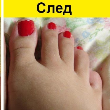 След