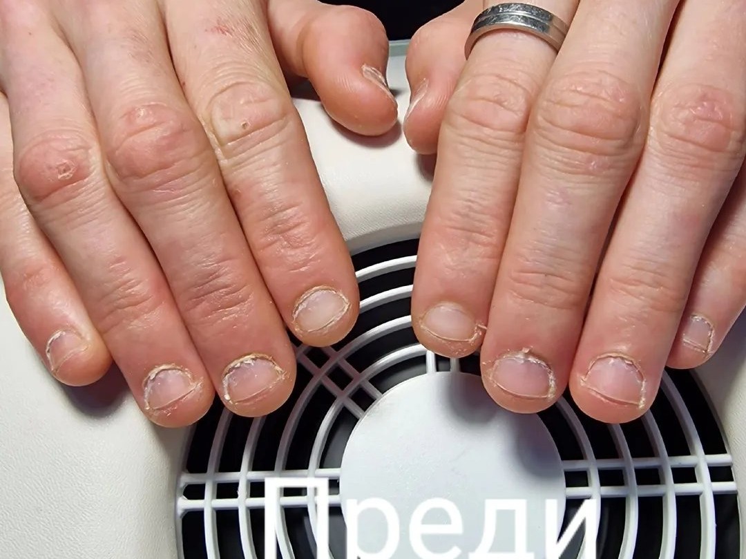 Преди