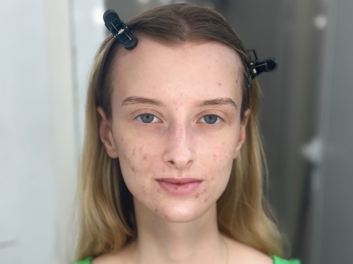 Преди