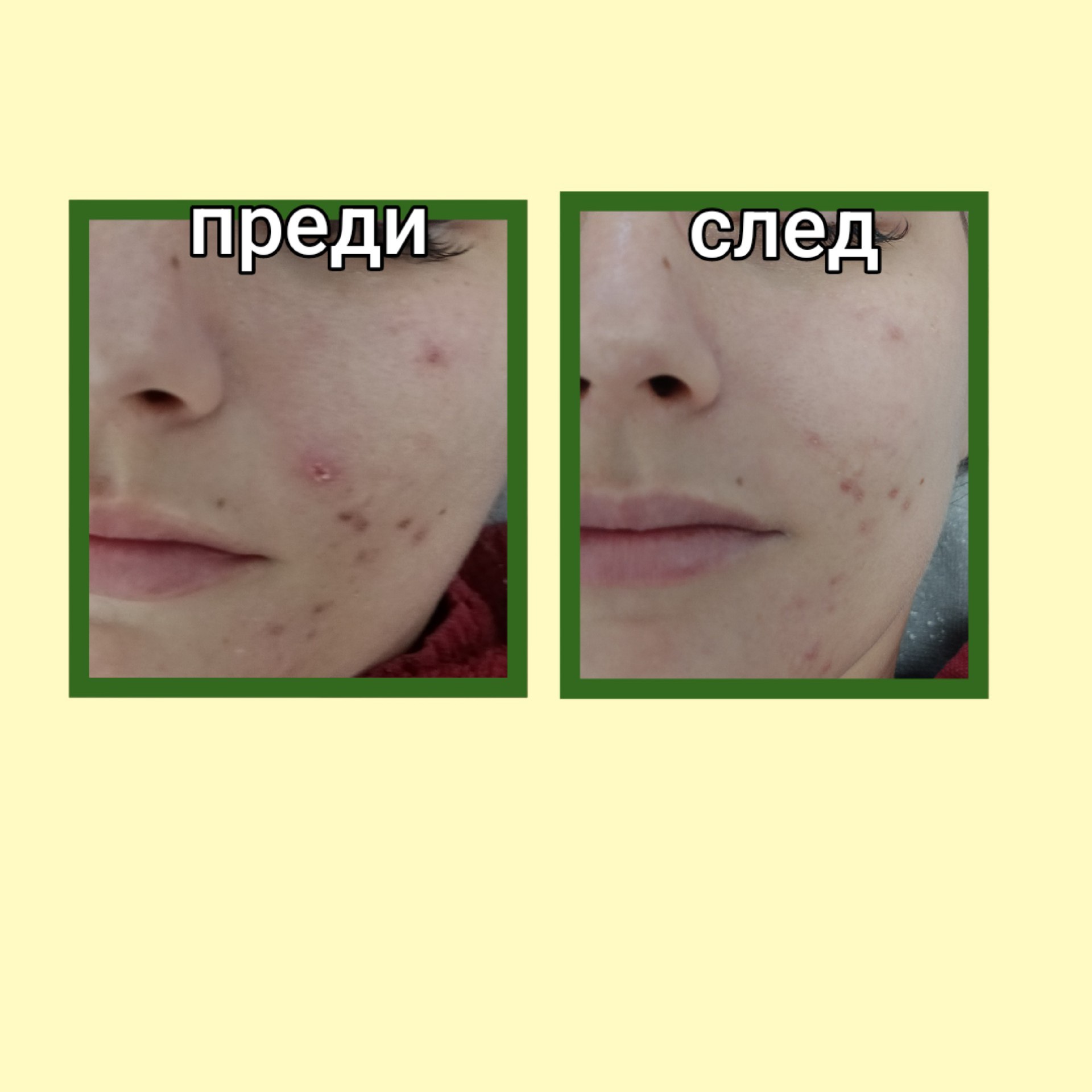 Дълбоко почистваща терапия