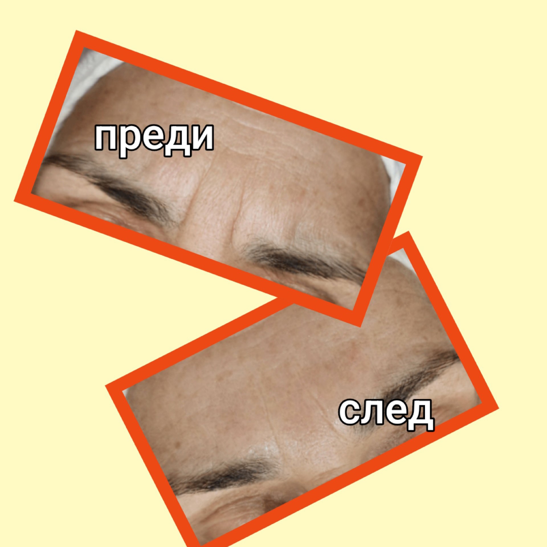 Масаж на лице,шия, деколте