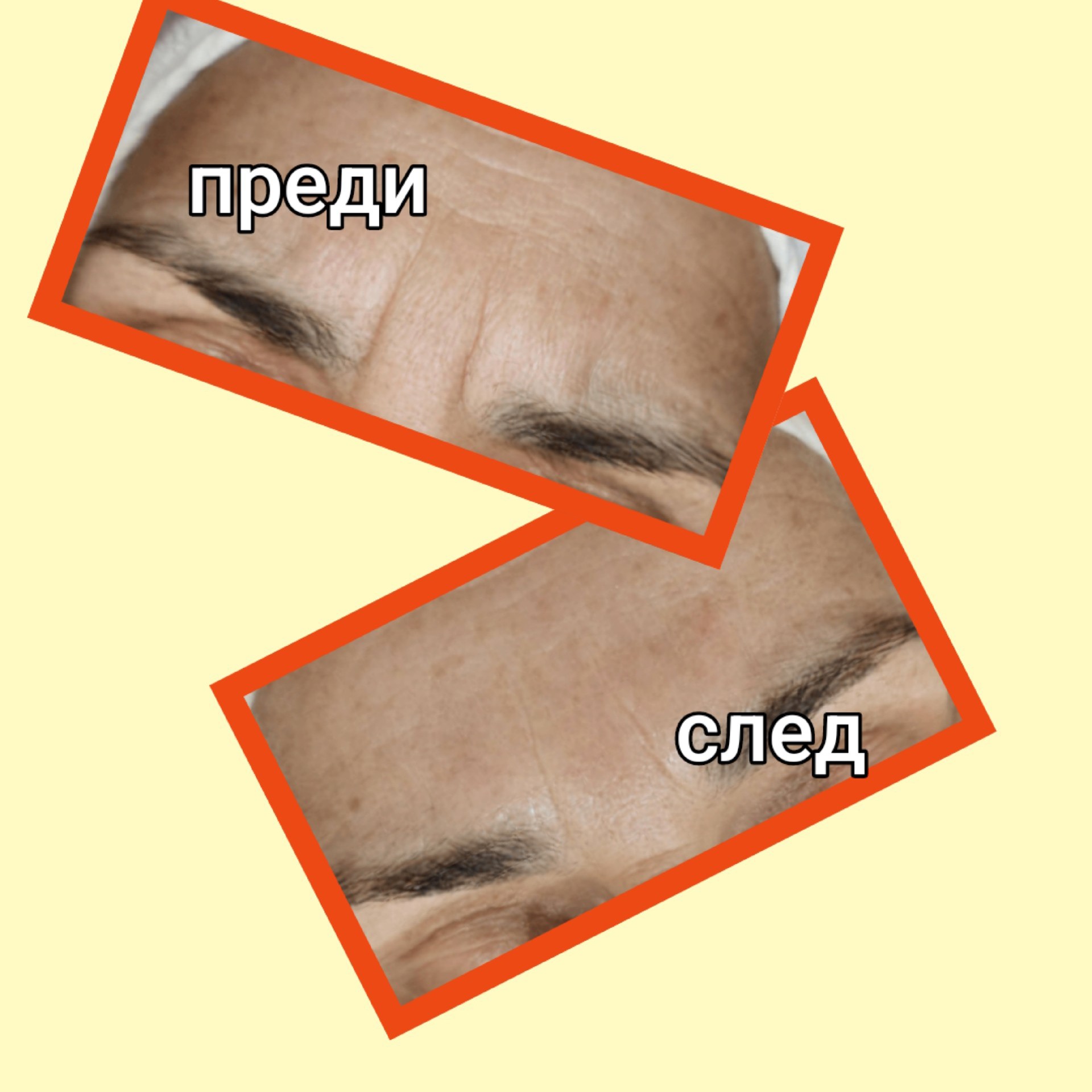 Масаж на лице